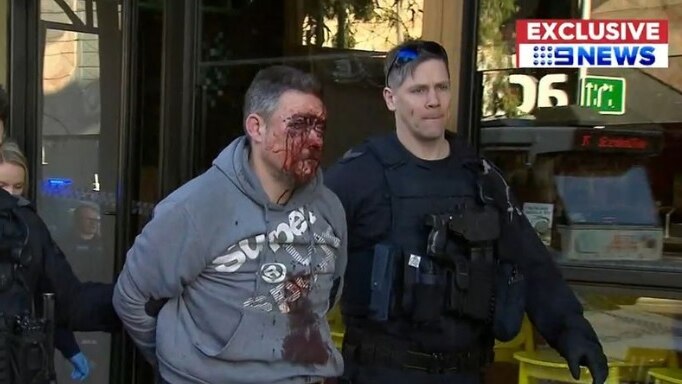 A man with a face covered in blood is escorted by police who are wearing black flack jackets.