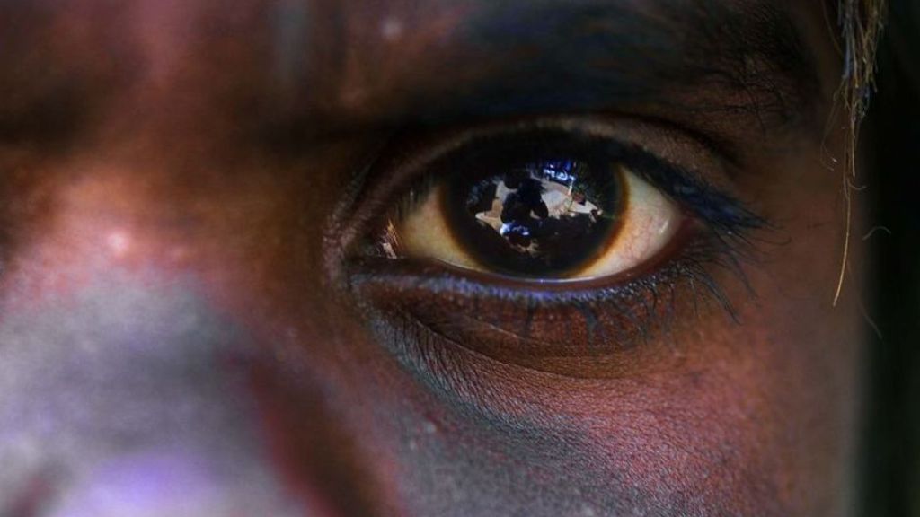 The 50 Year fight to end trachoma episode artwork