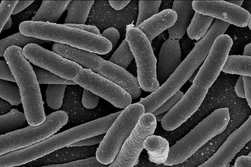 Escherichia coli under the microscope