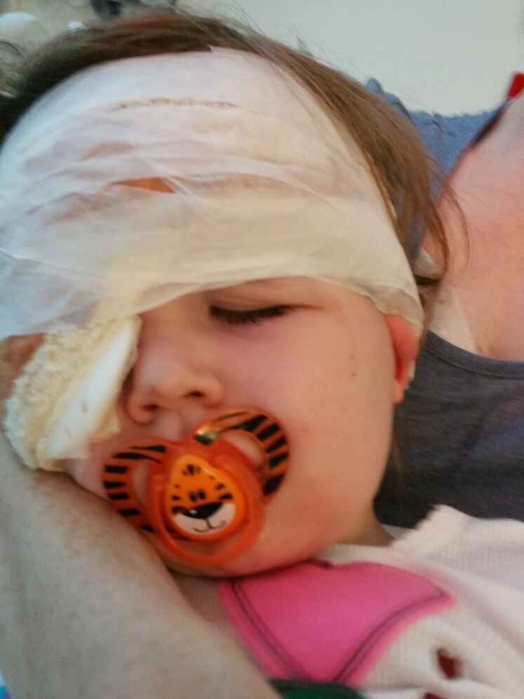A toddler with a tummy and post-operative bandages around her head and right eye