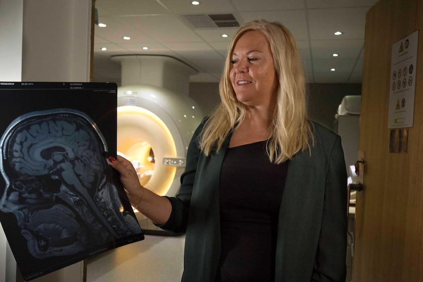 Sylvia Gustin holds a scan showing a person's brain inside their head