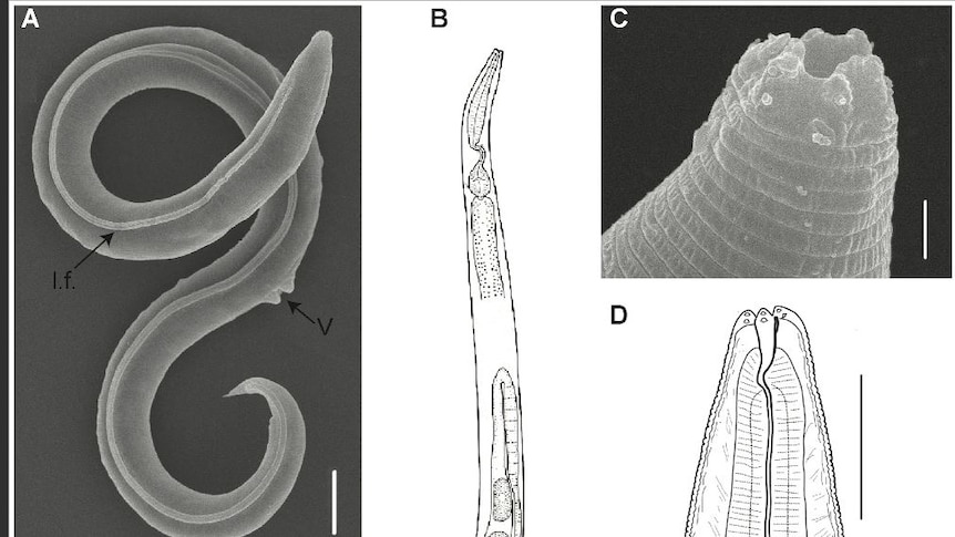 Four different pictures of what the worm looks like 