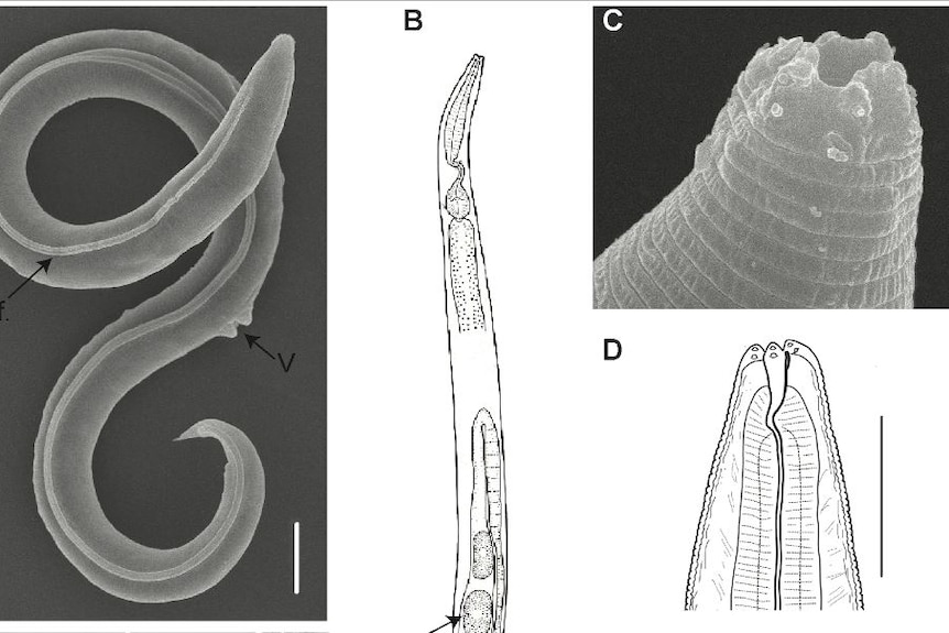 Four different pictures of what the worm looks like 