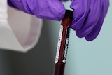 An analyst handles a vial of blood in the anti-doping laboratory in Harlow, England,