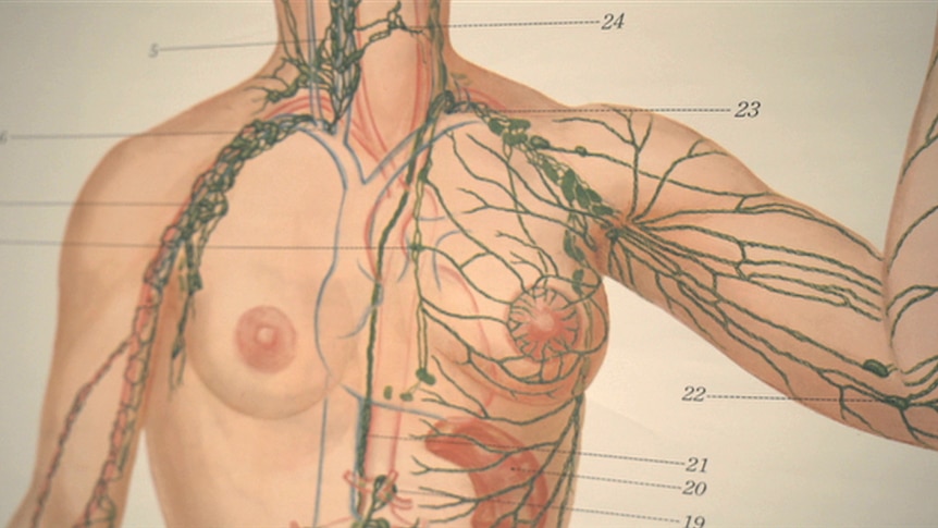 A drawing showing lines through a human torso.