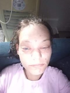 A selfie of Teisha Keley shows injuries and a swollen face