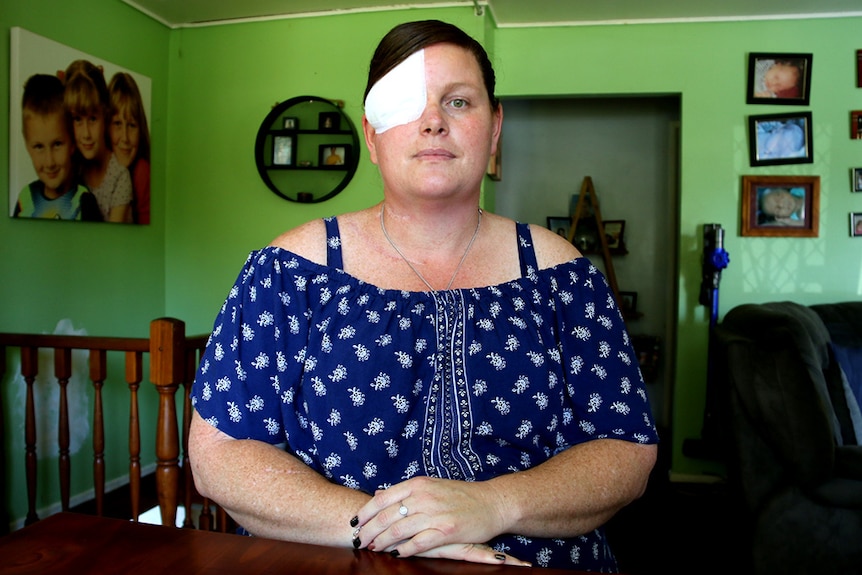 A portrait of Stacey Ferguson, who has a large patch over one eye, sitting at the dinner table