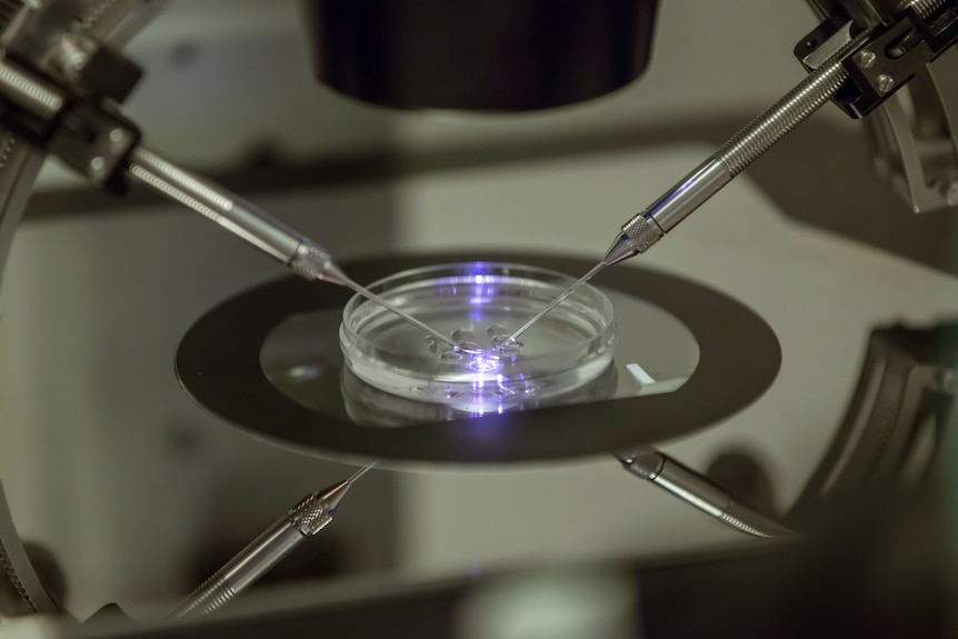 An image of a microscope above a petri dish with some fluid in it.