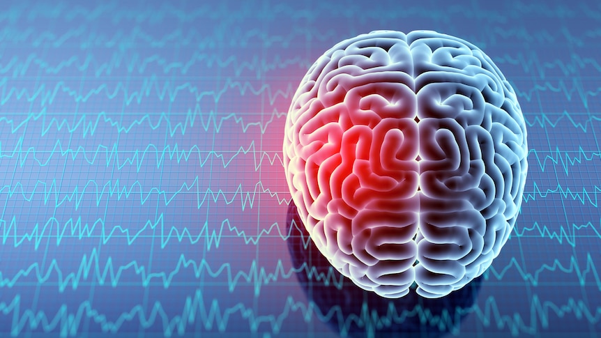 3D illustration of a brain with a red spot on the right hemisphere