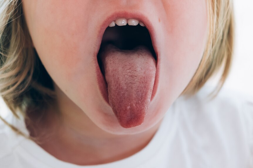 Closer up of child with open mouth
