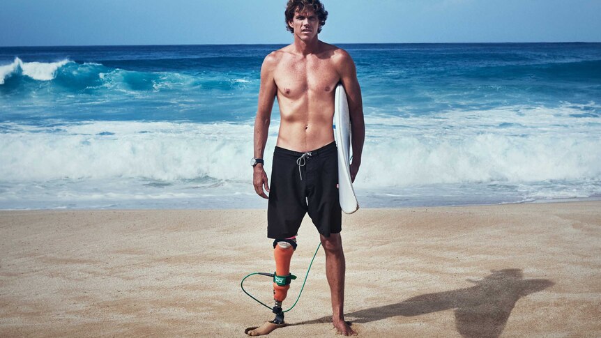 A man with a prosthetic right leg stands in front of the ocean wearing board shorts and holding a surfboard.