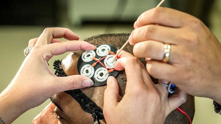 Electrodes being placed on a man's scalp.