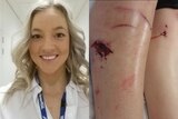 Michaela Vodvarka and injuries