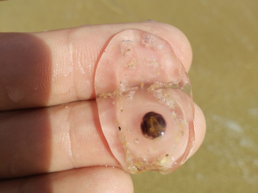 Clear blob with brownish spot sits on a person's fingers at the beach.