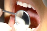 A universal dental healthcare scheme was one of Labor's pledges.