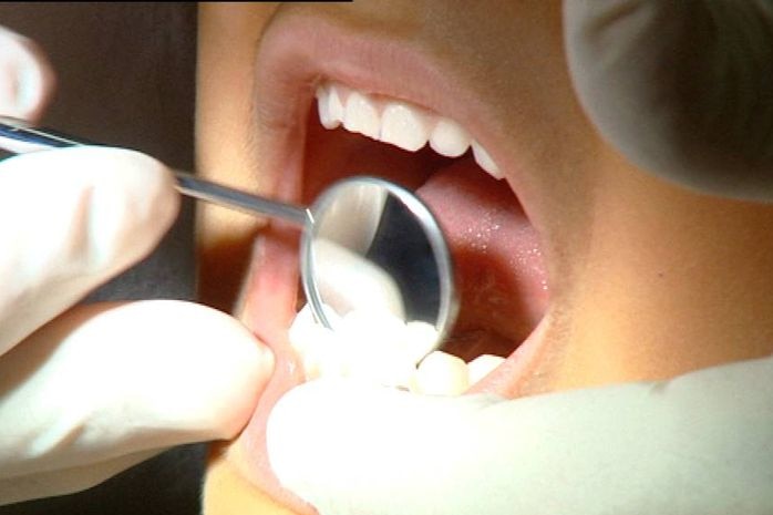 TV still of close-up of open human mouth with dentist examining teeth with dental mirror instrument