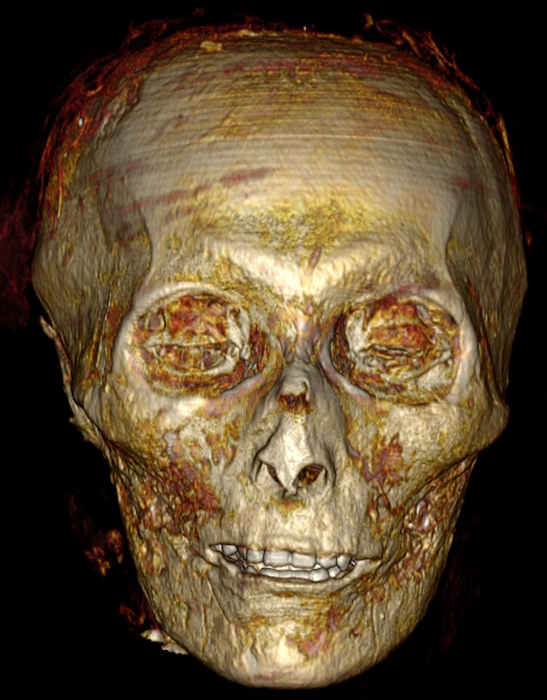A computer generated image of a skull, with teeth its in good condition. 