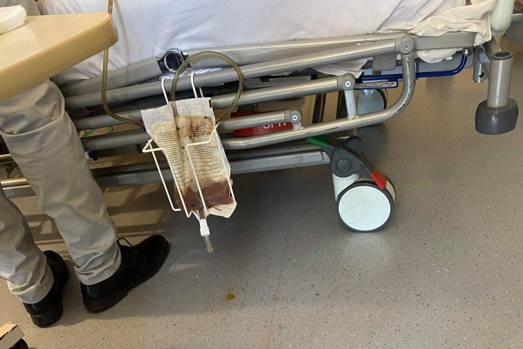 A catheter bag attached to a hospital bed.