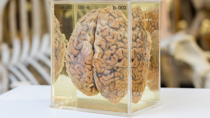 Brain of philosopher UT Place in a glass container at the University of Adelaide.