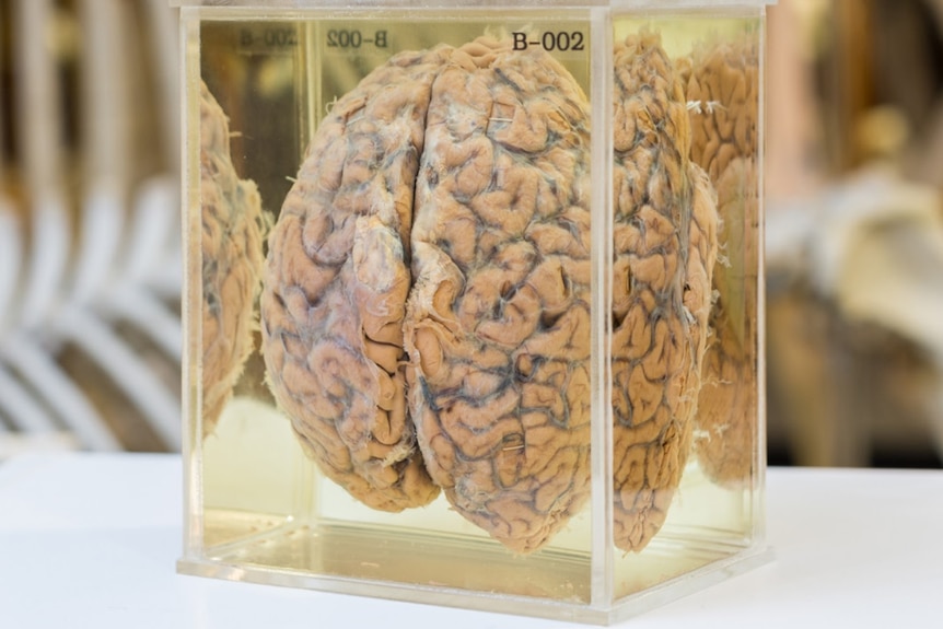 Brain of philosopher UT Place in a glass container at the University of Adelaide.