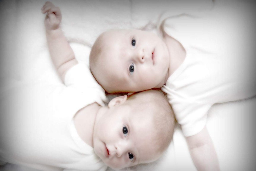 Twins Alexander and Abigail
