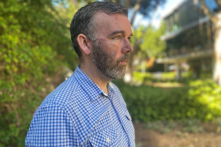 An image of Dan Angus side on with a visible scar running from his ear, across his cheek to near his nose, down to his beard 