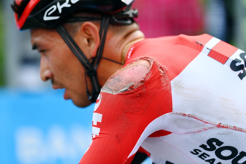 A cyclist wearing red and white has cuts and grazes on his shoulder after a crash