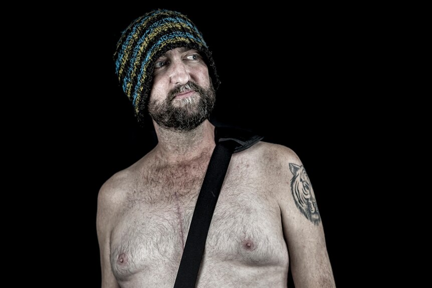 A man stands shirtless, exposing a big chest scar, wearing a beanie and with a bag over his shoulder.