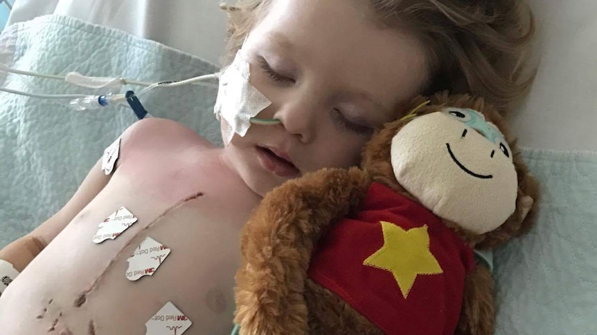 Two-year-old Arthur Long recovering from meningococcal