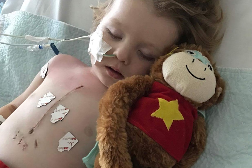 Two-year-old Arthur Long recovering from meningococcal