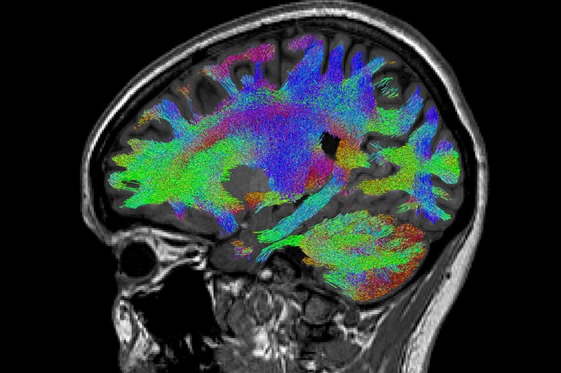 Brain scan slice showing colours