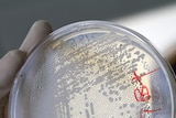Unknown source: The bacteria has killed 23 people and left thousands ill