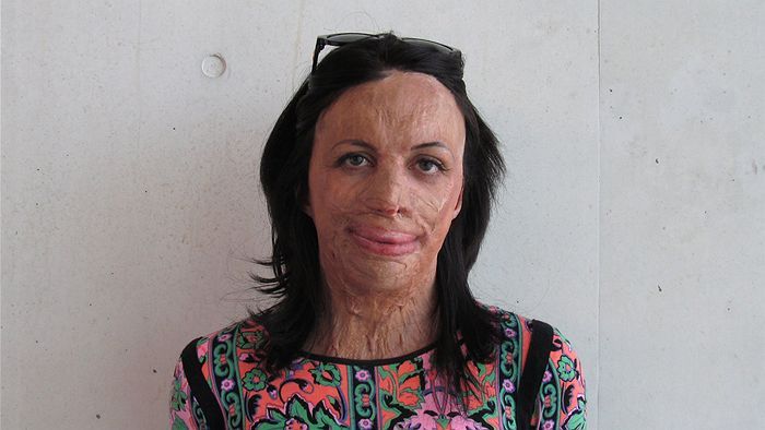 Turia Pitt's survival story of being trapped in a bushfire episode artwork
