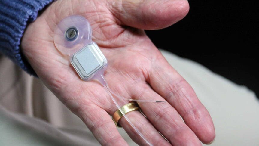 Dr Rice holds his cochlear implant