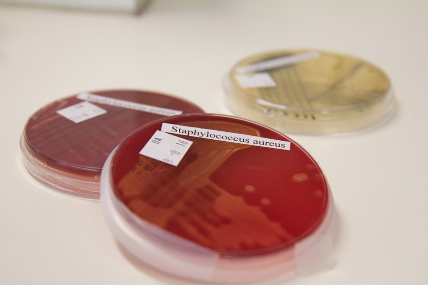 Petri dish of Staphylococcus aureus