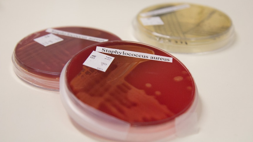 Petri dish of Staphylococcus aureus