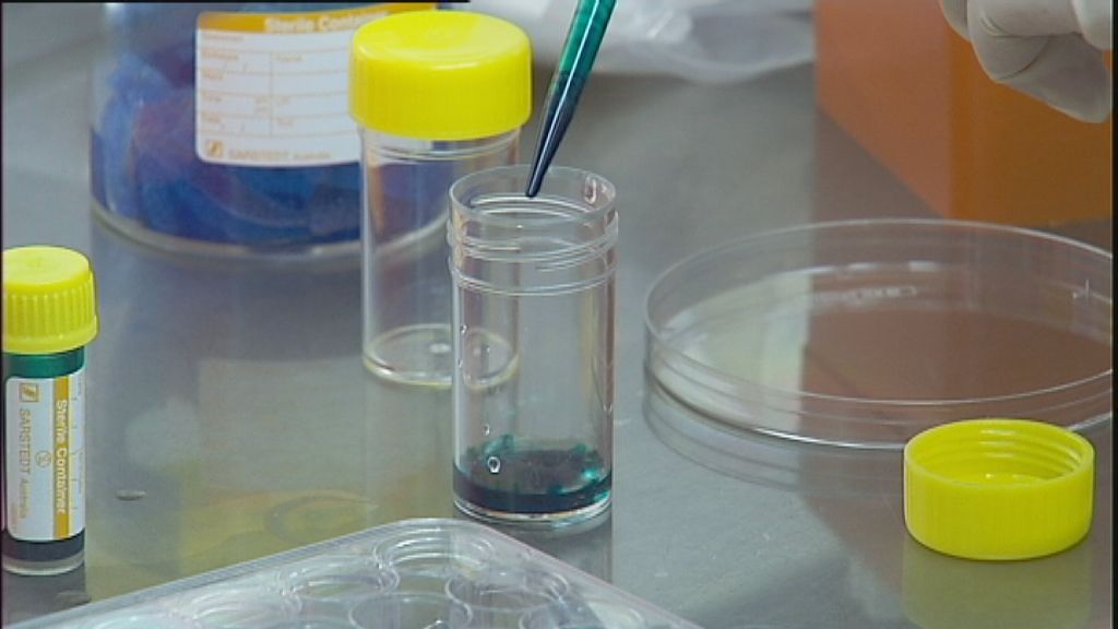 Prostate cancer research boost ABC News