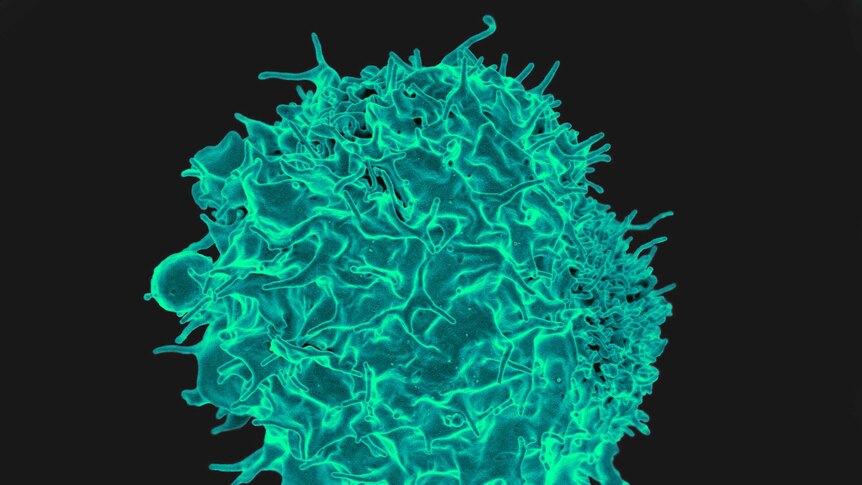 Scanned electron micrograph of a T cell.