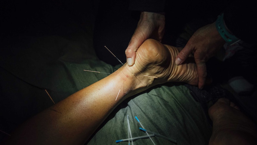 Hands holding ankle as dry needling is inserted