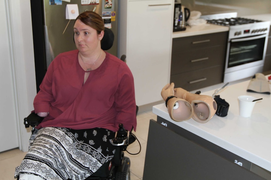 Korina Valentine sits with her prosthetic arms on the kitchen bench, after having her arms and legs partially amputated