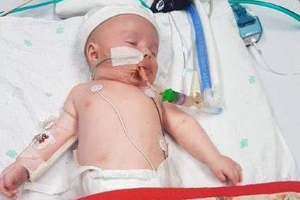 A baby lies in hospital surrounded by breathing tubes and other medical equipment