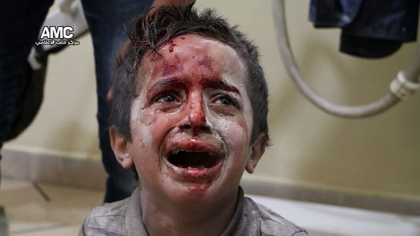 An injured boy at a hospital in Aleppo