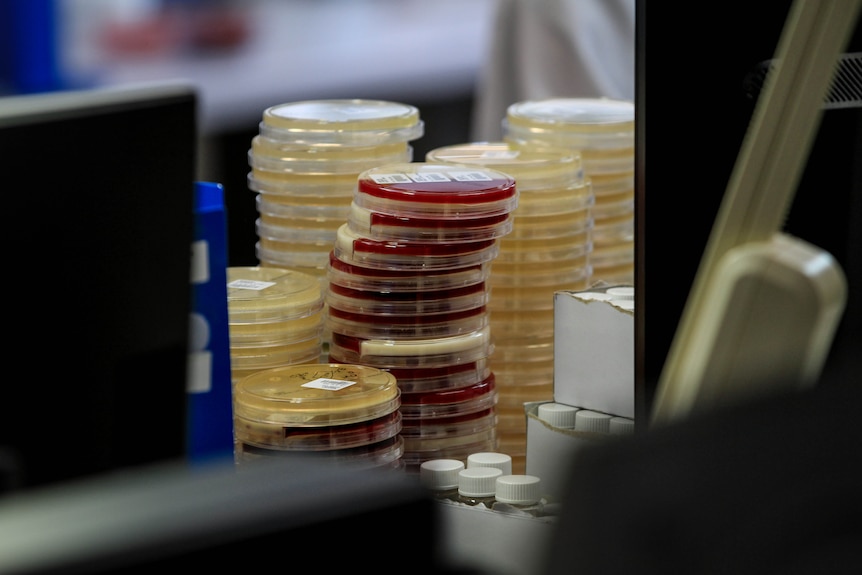 Stack of small plastic containers with red and yellow samples inside, pictured in a lab setting.
