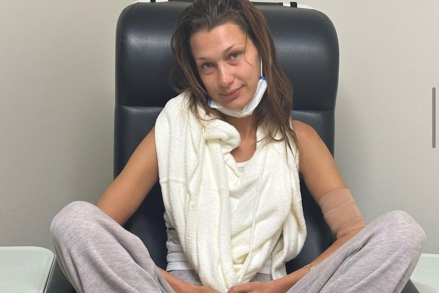 A young woman with a medical face mask under her chin sits in a chair and looks at the camera with a half-smile.