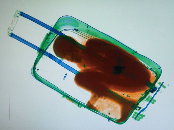 X-ray image shows boy in suitcase