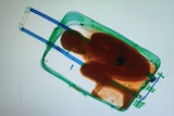 X-ray image shows boy in suitcase