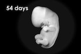 A snapshot of a baby embryo 54 days in.