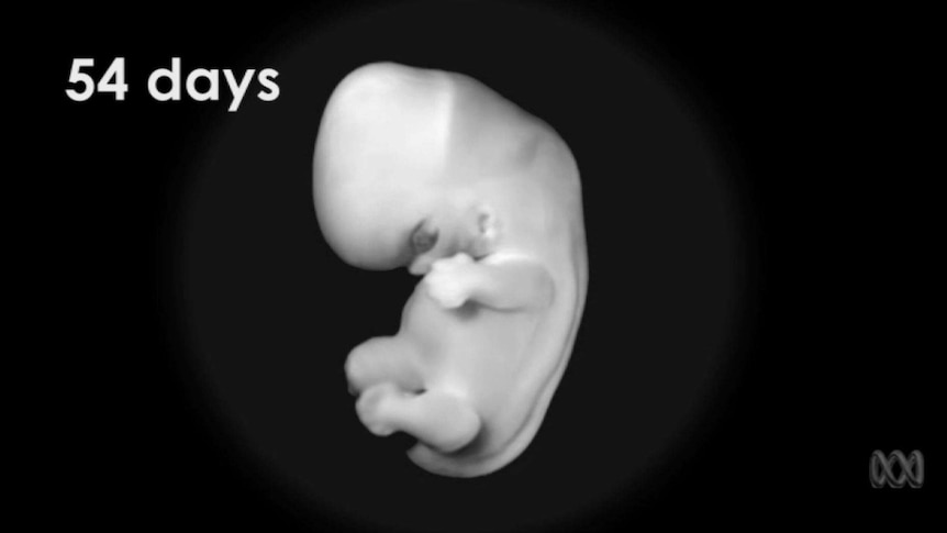 A snapshot of a baby embryo 54 days in.