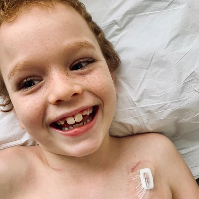 Young boy laying down smiling with a bare chest. He has a white catheter near his left shoulder