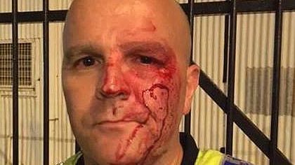 Police officer Nick Carter's bloody face after he was punched outside Monsoons nightclub on October 21, 2016